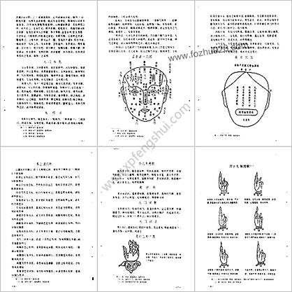 中医古籍整理丛书-116小儿推拿广意-清.熊应雄