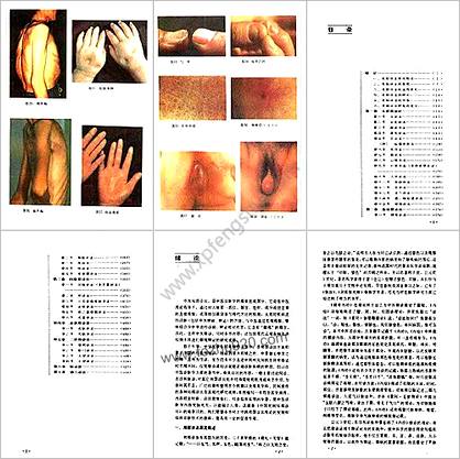 中国民间局部诊法_彭清华