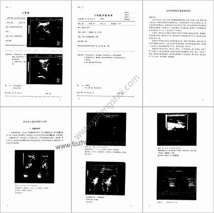 刘越溶石法治疗肝胆结石症_刘越