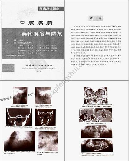 口腔疾病误诊误治与防范