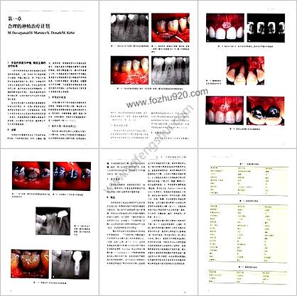 国际牙科名着系列-口腔种植学临床操作指南