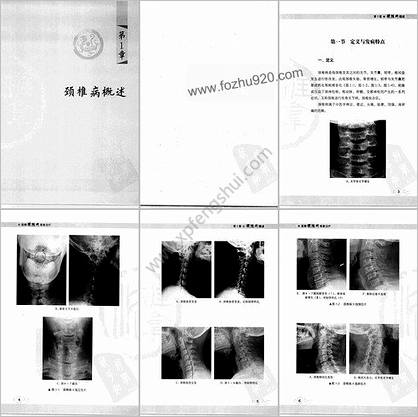 图解颈椎病推拿治疗-中文版