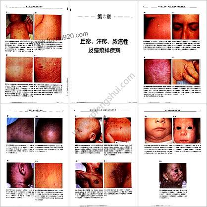 小儿皮肤病诊断彩色图谱