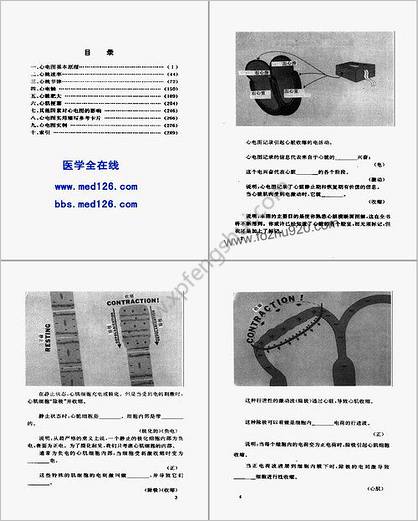 心电图图解速成讲授