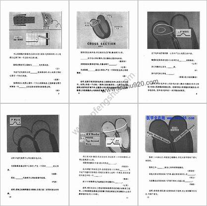 心电图图解速成讲授