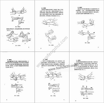 民间正骨诀窍