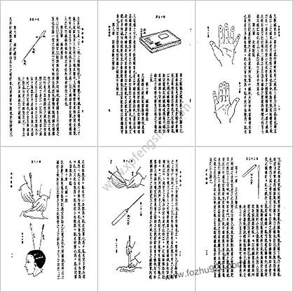 皇汉医学-10针学通论-日.佐藤利信