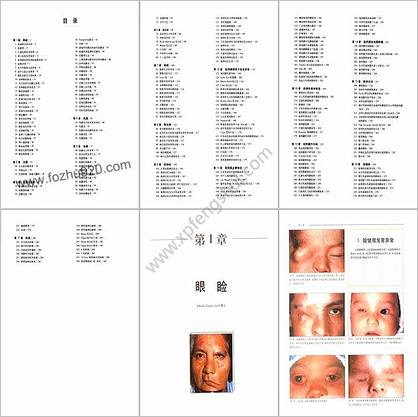 眼科诊断彩色图谱_高清彩图版