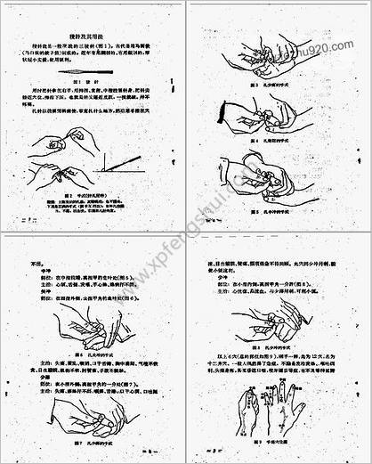 简易针灸治疗法_放血和艾灸_1