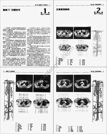 胸部CT诊断图谱