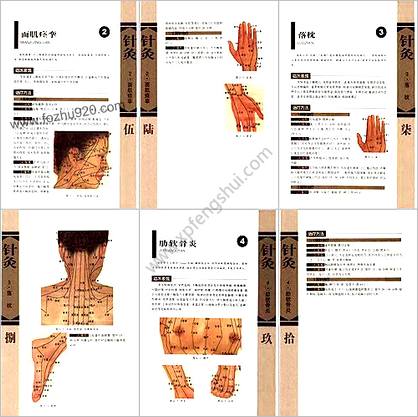 针灸治疗常见病证图解-骨伤科分册_张建华.扫描