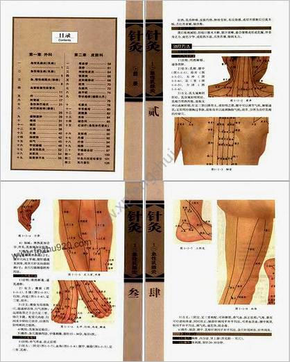 针灸治疗常见病证图解外科-皮肤科分册_张建华