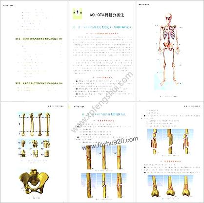 骨折分类三维图典_顾冬云